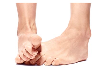 Foot Trooper – remède naturel contre les mycoses des pieds et des ongles